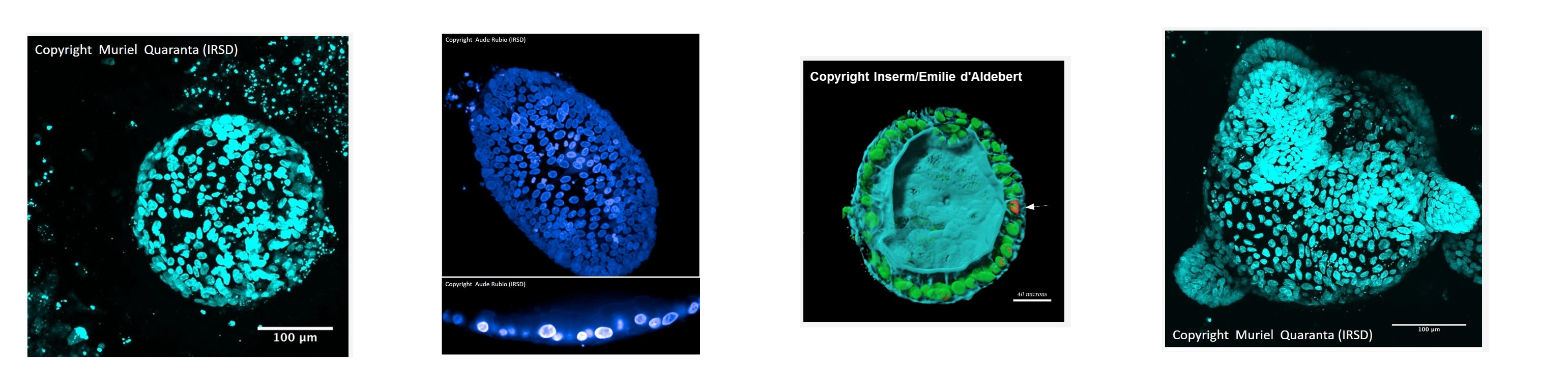 Organoid IRSD